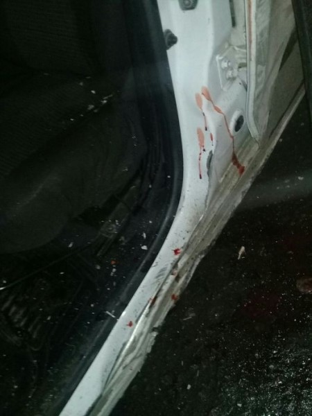 Молодой омич в странной аварии потерял ногу