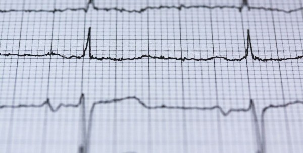 Омич спрятал в кустах дорогостоящее медоборудование