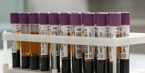 Генпрокуратура: Минздрав исправит ошибку с подорожавшей шофёрской медкомиссией