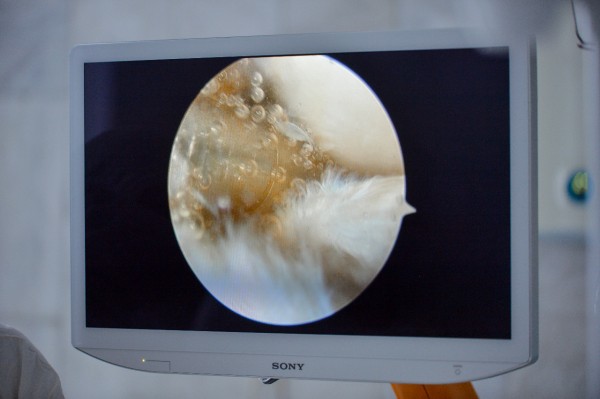 В Омске начали лечить суставы при помощи уникального комплекса