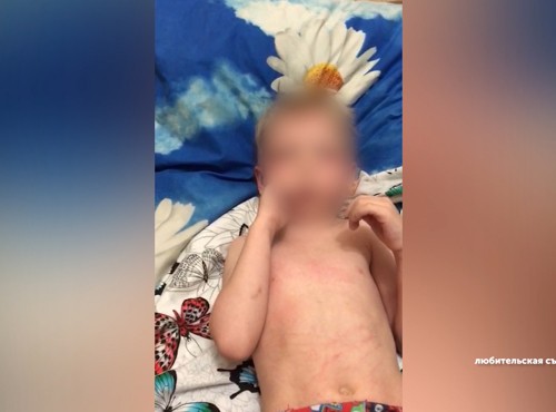 Отчим истязал и "бил, и бил, и бил" 4-летнего пасынка, заведено уголовное дело