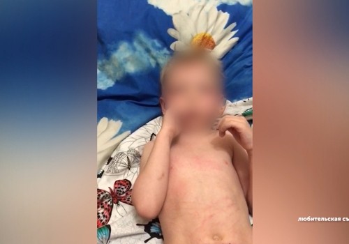 Стало известно об истязаниях еще одного мальчика в Омска