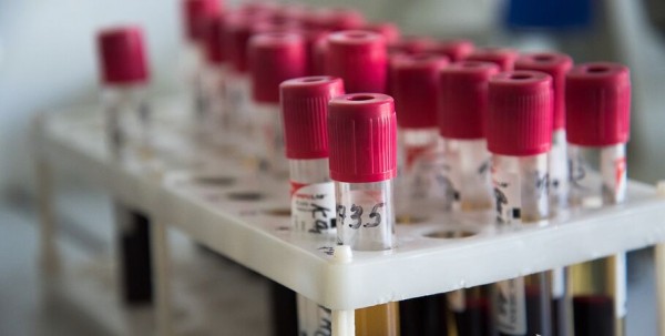 В Омске готовы диагностировать китайский коронавирус за пару часов