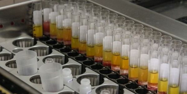 В Омск на борьбу с коронавирусом поступит 22 млн рублей