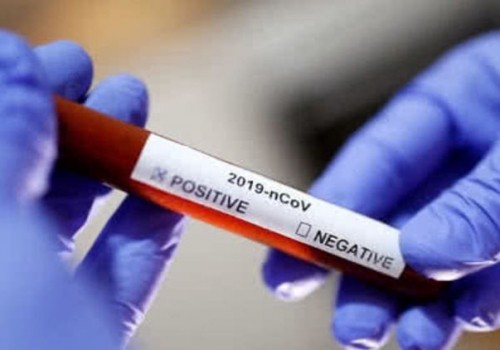 Рекорд дня: коронавирус выявили сразу у девяти омичей