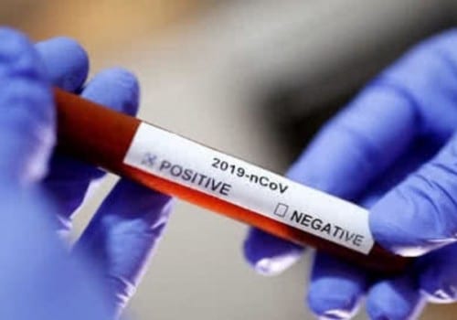 Число зараженных COVID-19 в Омской области может вырасти до тысячи уже через неделю