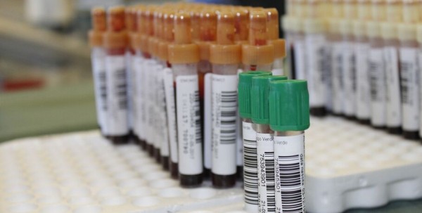 В Омской области подтвердили 58 новых случаев заражения коронавирусом