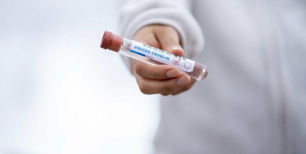 В омских лабораториях выявили 47 новых случаев заражения COVID-19 В омских лабораториях выявили 47 новых случаев заражения COVID-19