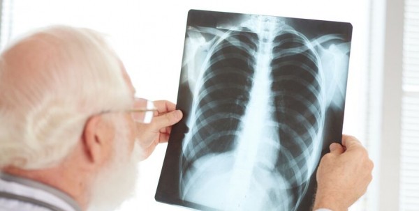 COVID-19 унёс жизни 64 омичей