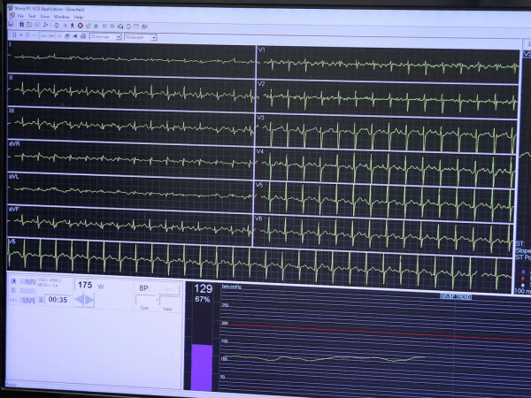 
        ПОДСЛУШАНО: МЕДОСМОТР | «Авангард» на предсезонке (ВИДЕО)
      