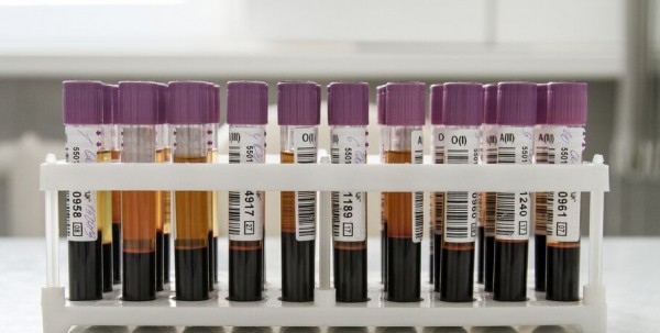 В Омске начато тестирование упрощённой системы сдачи теста на антитела