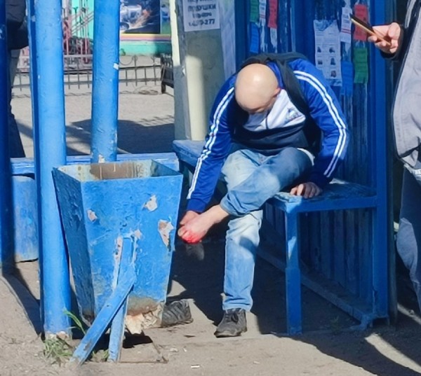 
									В Омске маршрутчик наехал на ногу пассажира   [ФОТО]  