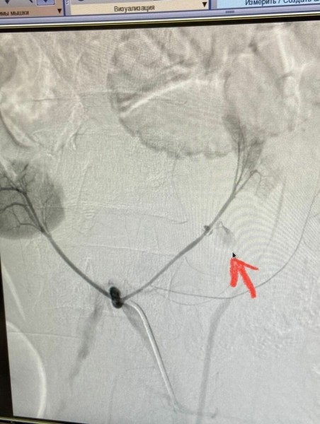 Омские врачи спасли мужчину, который истекал кровью по неизвестной причине — ФОТО