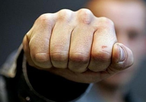 Омич заявил, что замначальника отдела УГИБДД ударил его головой в нос