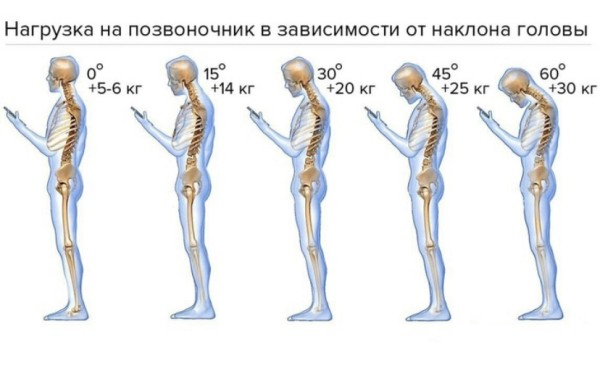 Как сохранить молодость лица без уколов красоты и пластики?
Как сохранить молодость лица без уколов красоты и пластики?