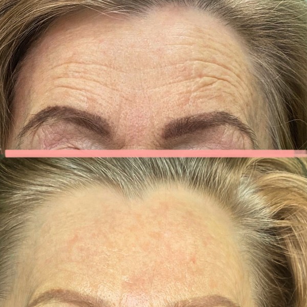 Как сохранить молодость лица без уколов красоты и пластики?
Как сохранить молодость лица без уколов красоты и пластики?