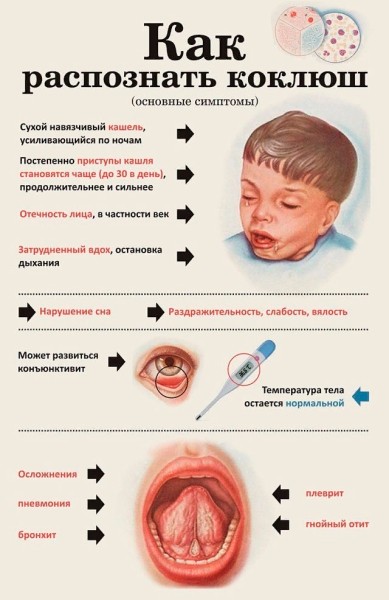 
									В Омской области стали чаще болеть коклюшем 